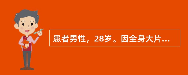 患者男性，28岁。因全身大片瘀斑、臂出血难止前来就诊。实验室检查：WBC3.5×10<img border="0" style="width: 10px; heig