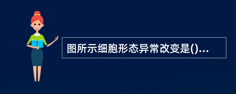 图所示细胞形态异常改变是()<img border="0" style="width: 360px; height: 270px;" src="