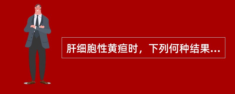 肝细胞性黄疸时，下列何种结果是正确的