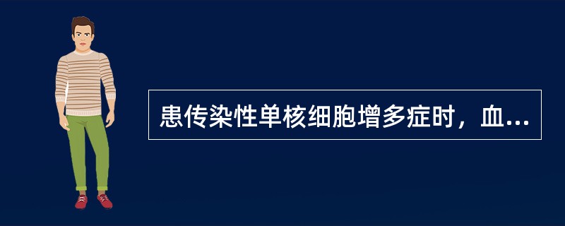 患传染性单核细胞增多症时，血涂片可发现较多的细胞是（）