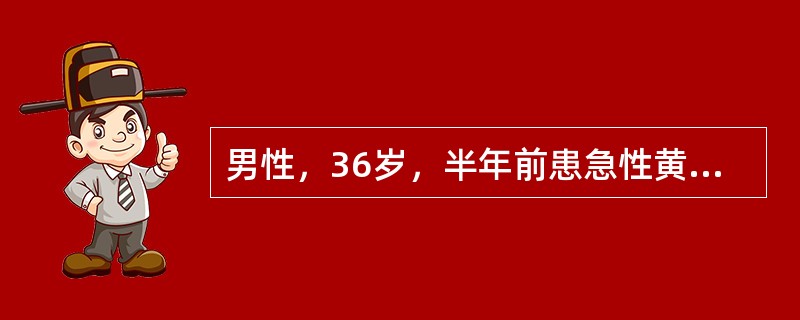 男性，36岁，半年前患急性黄疸型肝炎，半个月来发热、牙龈出血。体检：重度贫血貌，肝肋下2cm，脾肋下刚触及。检验：红细胞8×10<img border="0" style=&