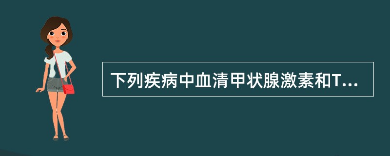 下列疾病中血清甲状腺激素和TSH浓度均升高的是