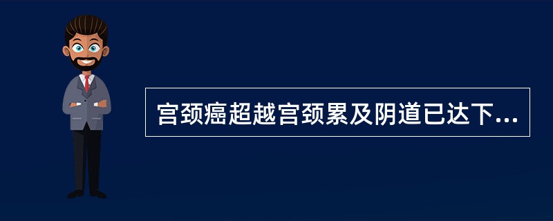 宫颈癌超越宫颈累及阴道已达下1/3，无宫旁浸润，按FIGO2009的临床分期，应属于