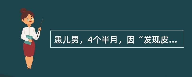 患儿男，4个半月，因“发现皮肤黄疸2周”来诊。查体：皮肤、巩膜中度黄染；肝肋下2cm，脾肋下1cm。肝功能：TBil82μmol/L，DBil38μmol/L，ALT95U/L，AST86U/L。临床