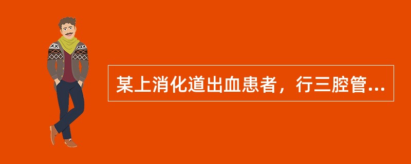 某上消化道出血患者，行三腔管止血，晨间护理发现出血已停止，可考虑