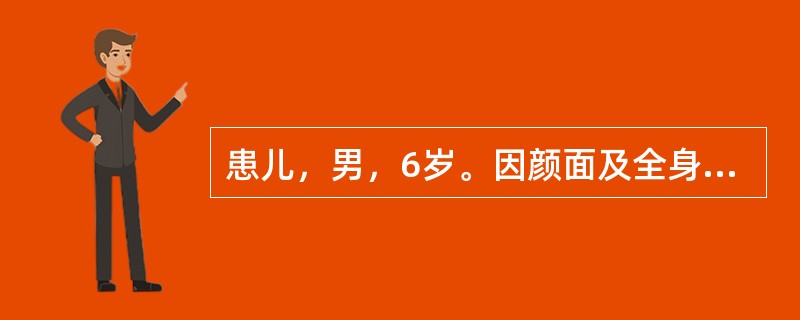 患儿，男，6岁。因颜面及全身水肿就诊，门诊以“肾病综合征”收入院。查体：面部、腹壁及双下肢明显水肿，呈凹陷性，腹部膨隆，腹水征(+)，阴囊明显水肿，囊壁变薄透亮呈球形。实验室检查：尿蛋白(++++)，