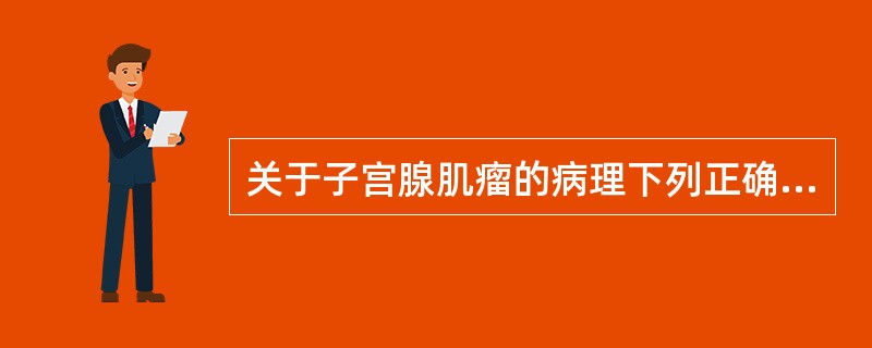 关于子宫腺肌瘤的病理下列正确的是