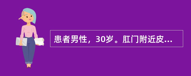 患者男性，30岁。肛门附近皮肤反复破溃、溢脓2年余。局部检查：肛周右侧距肛门约4cm处有一乳头状隆起，挤压后有少许脓液排出。首先考虑的疾病是