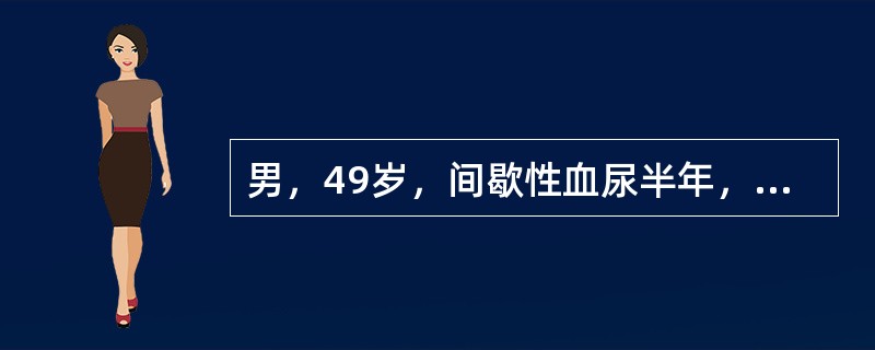 男，49岁，间歇性血尿半年，行膀胱镜检查后，不愿饮水，护士向其解释多饮水的目的是