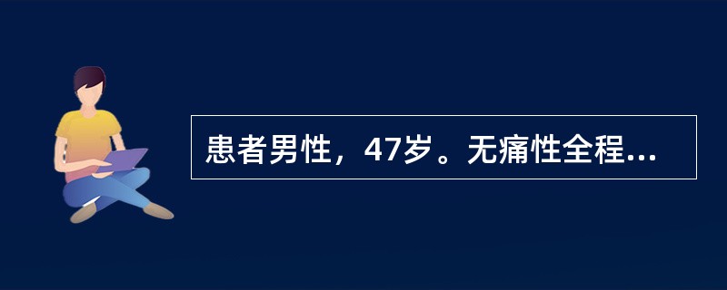 患者男性，47岁。无痛性全程血尿2个月，查体无异常。IVP：左肾上盏拉长、变窄，边缘不规则。最可能的诊断是