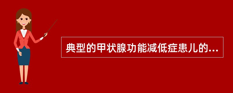 典型的甲状腺功能减低症患儿的临床表现应除外