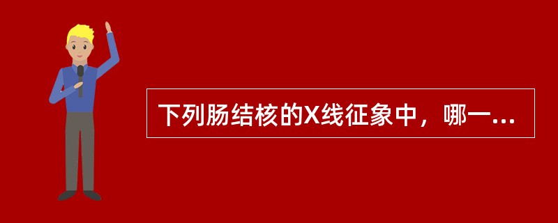 下列肠结核的X线征象中，哪一项是错误的