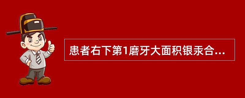 患者右下第1磨牙大面积银汞合金充填，远中食物嵌塞，要求修复如果此牙为死髓牙，牙冠缺损3／4，未行根管治疗，根长大，牙槽骨良好则最佳的治疗方案为（）