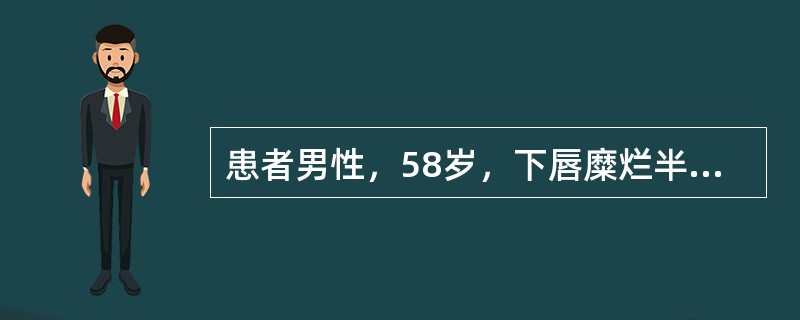 患者男性，58岁，下唇糜烂半年不愈。临床检查见下唇唇红部有1cm×2cm红色萎缩斑，中央微凹陷，边缘隆起有放射状白色角化条纹。口腔内未见它处病损下列哪项不是该病的病理表现（）