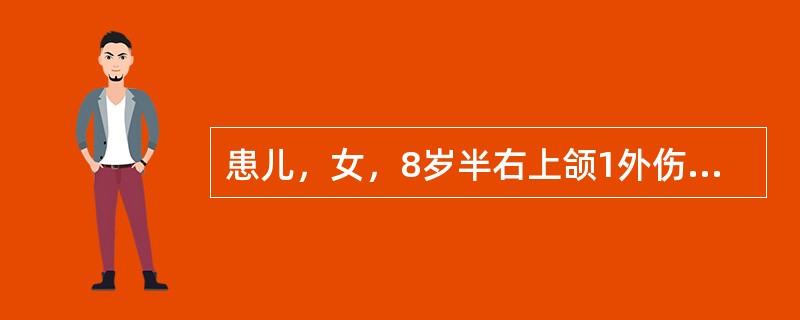 患儿，女，8岁半右上颌1外伤冠折，1切角缺损，即刻来院就诊。口腔检查：穿髓孔大，探痛（+++），叩痛（±）。治疗首先（）