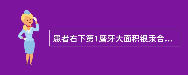 患者右下第1磨牙大面积银汞合金充填，远中食物嵌塞，要求修复与铸造桩核相比，预成桩加树脂桩核的优点是（）