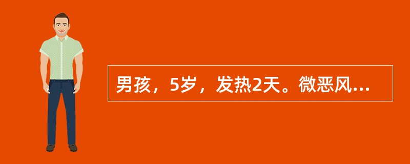 男孩，5岁，发热2天。微恶风寒。鼻塞流涕，咳嗽，眼睑红赤，泪水汪汪，口腔颊黏膜红赤，见有细小白色疹点，周围红晕，小便黄，舌苔薄黄，治疗首选方剂是