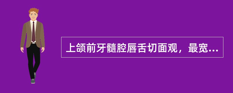 上颌前牙髓腔唇舌切面观，最宽处在（）