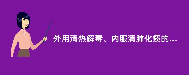 外用清热解毒、内服清肺化痰的药物是