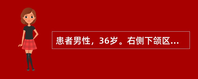 患者男性，36岁。右侧下颌区无痛性肿胀逐渐加重八月，无疼痛及麻木感。检查见面部不对称，右侧下颌区膨隆。表面皮肤色、温正常。口内相应区域移行沟丰满，触诊有乒乓球感，穿刺可抽出褐色液体，显微镜下未见胆固醇