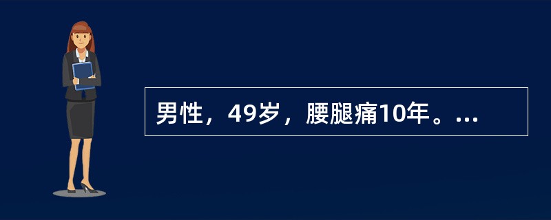 男性，49岁，腰腿痛10年。查体：腰5～骶1间压痛，并放射至小腿外侧，左侧直腿抬高试验阳性，加强试验阳性。最可能的诊断是（）