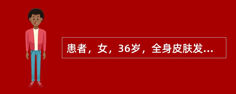 患者，女，36岁，全身皮肤发黄，颜色鲜明如橘皮，伴有发热、头痛，舌红苔黄，脉弦滑，宜首选