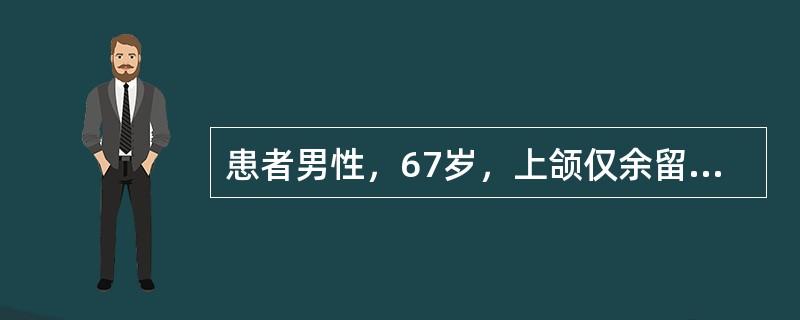 患者男性，67岁，上颌仅余留双侧尖牙，下颌双侧第一磨牙缺失，拟行可摘局部义齿修复，下颌设计舌杆大连接体<br /><br /><br />可摘局部义齿修复，制作基托