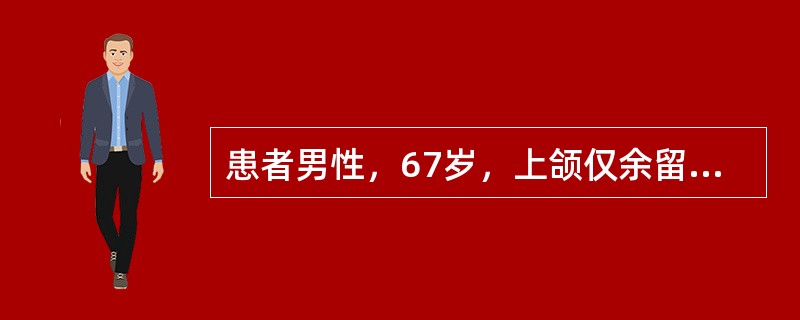 患者男性，67岁，上颌仅余留双侧尖牙，下颌双侧第一磨牙缺失，拟行可摘局部义齿修复，下颌设计舌杆大连接体<br /><br /><br />大连接体的主要作用是（）