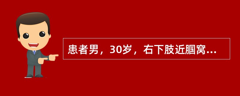 患者男，30岁，右下肢近腘窝处被刀刺伤后出现搏动性肿块，逐渐增大伴右下肢麻木，查体：右下肢苍白，腘窝部搏动性肿块大小为5cm×4cm，附近有收缩期杂音，诊断为