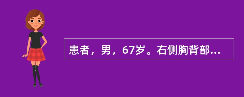 患者，男，67岁。右侧胸背部起疹5天，疼痛难忍，局部有集簇小水疱，疱壁紧张，色红，皮肤灼热刺痛，伴口苦咽干，烦躁易怒，大便干，小便黄，舌红，苔薄黄，脉弦滑数。其证候是：