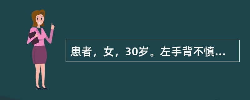 患者，女，30岁。左手背不慎被热汤灼伤，皮肤色红肿胀，疼痛剧烈，间有大小不等水疱，基底部潮红。其烧伤深度为