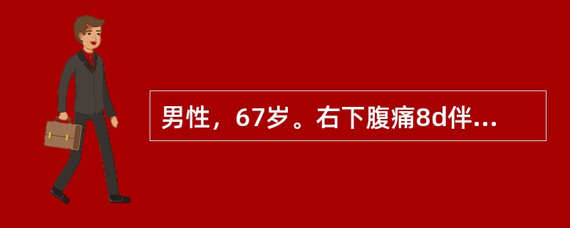 男性，67岁。右下腹痛8d伴呕吐，体温35℃，脉搏120次/分，血压10.7/6.67kPa（80/50mmHg），神志不清，烦躁不安，全腹压痛、反跳痛.四肢冰冷、青紫呈花斑发绀，尿量＜25ml/h。