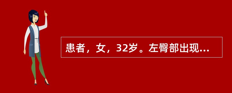 患者，女，32岁。左臀部出现硬结，红热不显，有触痛，步行不便，有患部肌肉注射史。应首先考虑的是（）