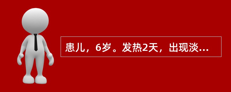 患儿，6岁。发热2天，出现淡红色小丘疹，根盘红晕，丘疹上部可见疱疹，形态椭圆，胞浆清亮，皮疹以躯干为多，苔薄白，脉浮数。其治法是