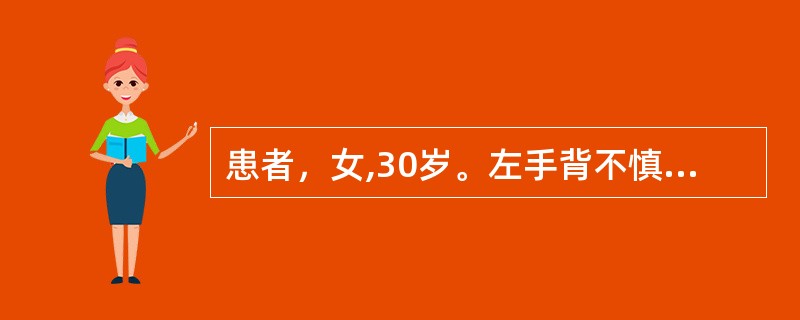 患者，女,30岁。左手背不慎被热汤灼伤，皮肤色红肿胀，疼痛剧烈，间有大小不等水疱，基底部潮红。其烧伤深度为