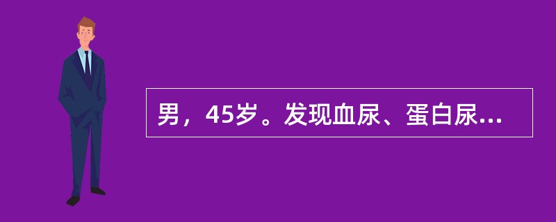 男，45岁。发现血尿、蛋白尿8年。查体：BP150/90mmHg。实验室检查：尿蛋白定量2～8g/d，血肌酐110μmol/L。临床诊断是（　　）。