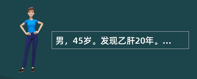 男，45岁。发现乙肝20年。超声检查：肝脏回声不均匀，脾大，门静脉增宽，腹水。肝穿刺病理的特征性发现是（　　）。