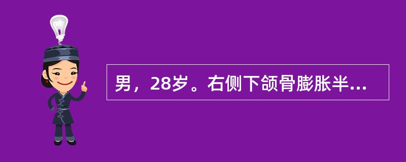 男，28岁。右侧下颌骨膨胀半年，偶有胀痛。检查：右侧下颌骨体部膨隆，可触及囊性感。曲面体层片示右下颌尖牙至下颌支前缘多房性透射性病变，病变膨隆明显，前磨牙和磨牙牙根锯齿状吸收，边缘可见切迹。最可能的诊