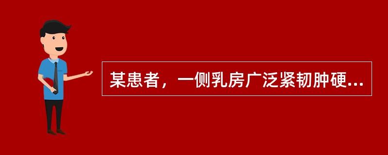 某患者，一侧乳房广泛紧韧肿硬，皮色紫红，皮肤呈橘皮样变，全身炎症反应不明显，应首先考虑为