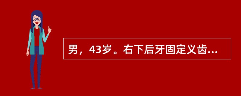男，43岁。右下后牙固定义齿修复2年，松动，咬合不适。查：45、44缺失，46～43固定桥，43的3/4冠固位体松动，龋坏，46全冠固位体未见异常。43固位体松动的原因是