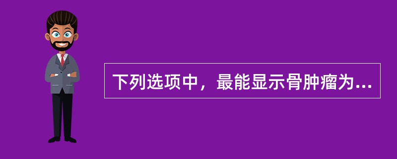 下列选项中，最能显示骨肿瘤为恶性的X线表现为