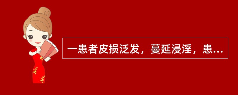 一患者皮损泛发，蔓延浸淫，患处皮肤红肿，痂厚；舌质红，苔黄腻，脉滑数，选用的方剂为