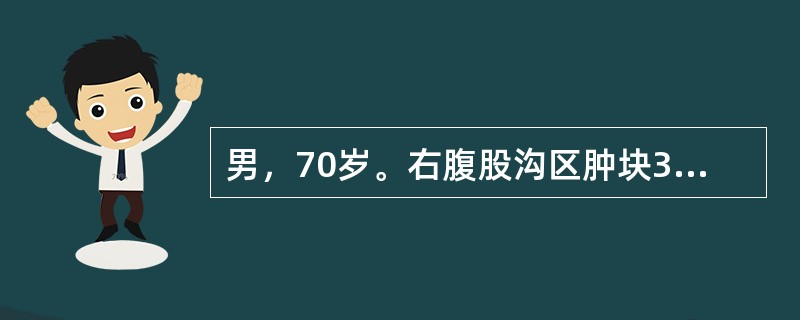 男，70岁。右腹股沟区肿块3年，平卧消失。查体：右耻骨结节外上方有一半球形肿块，未进入阴囊，可用手回纳，压住腹股沟韧带中点上方咳嗽时仍可见肿块突出。最可能的诊断是