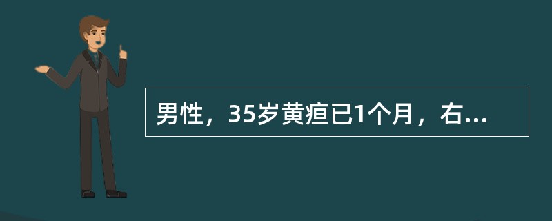 男性，35岁黄疸已1个月，右上腹轻微胀痛，食欲不振，经内科治疗无效。查体：肝大，胆囊增大，血胆红素170μmol/L，AST470单位，AKP545单位，AFP>5ng/ml，可能诊断是