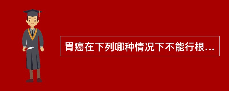 胃癌在下列哪种情况下不能行根治性手术