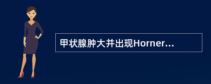 甲状腺肿大并出现Horner综合征时，最可能的诊断是