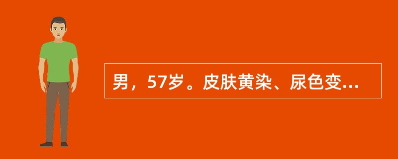 男，57岁。皮肤黄染、尿色变深伴皮肤瘙痒3周。查体：皮肤巩膜黄染，右上腹可触及无痛性圆形肿块，随呼吸上下活动。该肿块可能为