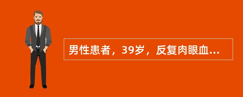 男性患者，39岁，反复肉眼血尿2月，IVP见左肾盂内有不规则充盈缺损，膀胱镜检见左侧输尿管口喷血，首先考虑的诊断是