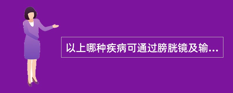 以上哪种疾病可通过膀胱镜及输尿管插管进行治疗（）