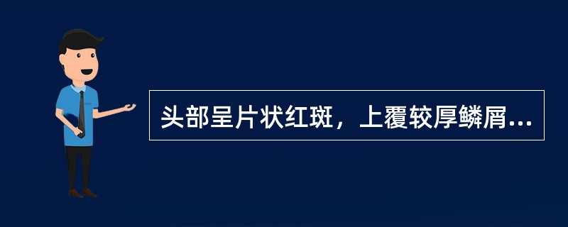 头部呈片状红斑，上覆较厚鳞屑，抓之呈点状出血，皮损超过发际（）